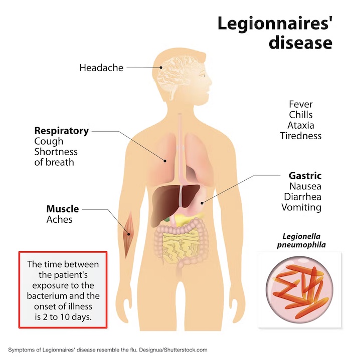 南加州疑似軍團病（Legionnaire）爆發 2人死亡 14人入院